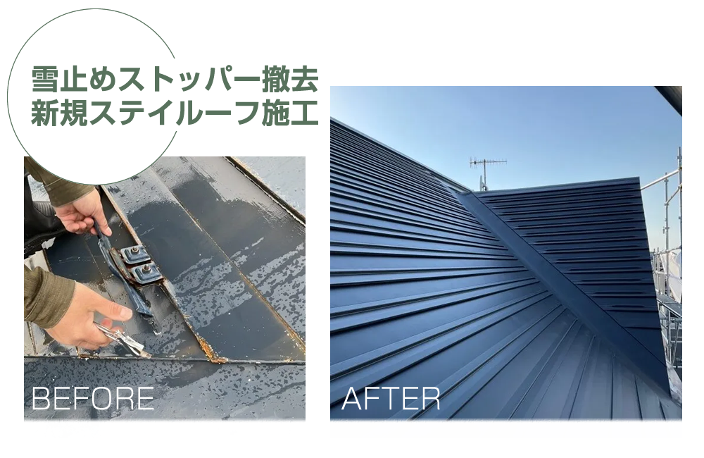 ビフォーアフター　雪止めストッパー撤去　新規ステイルーフ施工